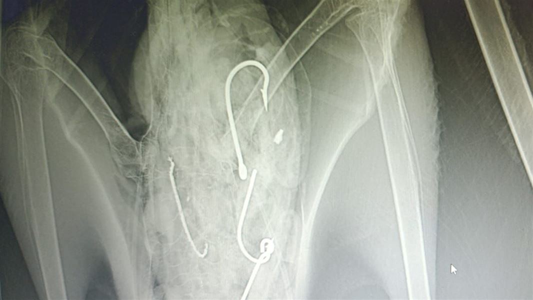 X-ray image showing fishing hooks inside albatross.